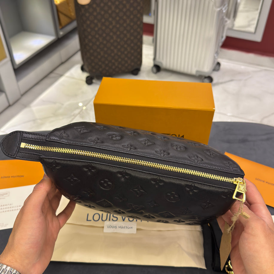 Louis Vuitton Bag Özel Ürün